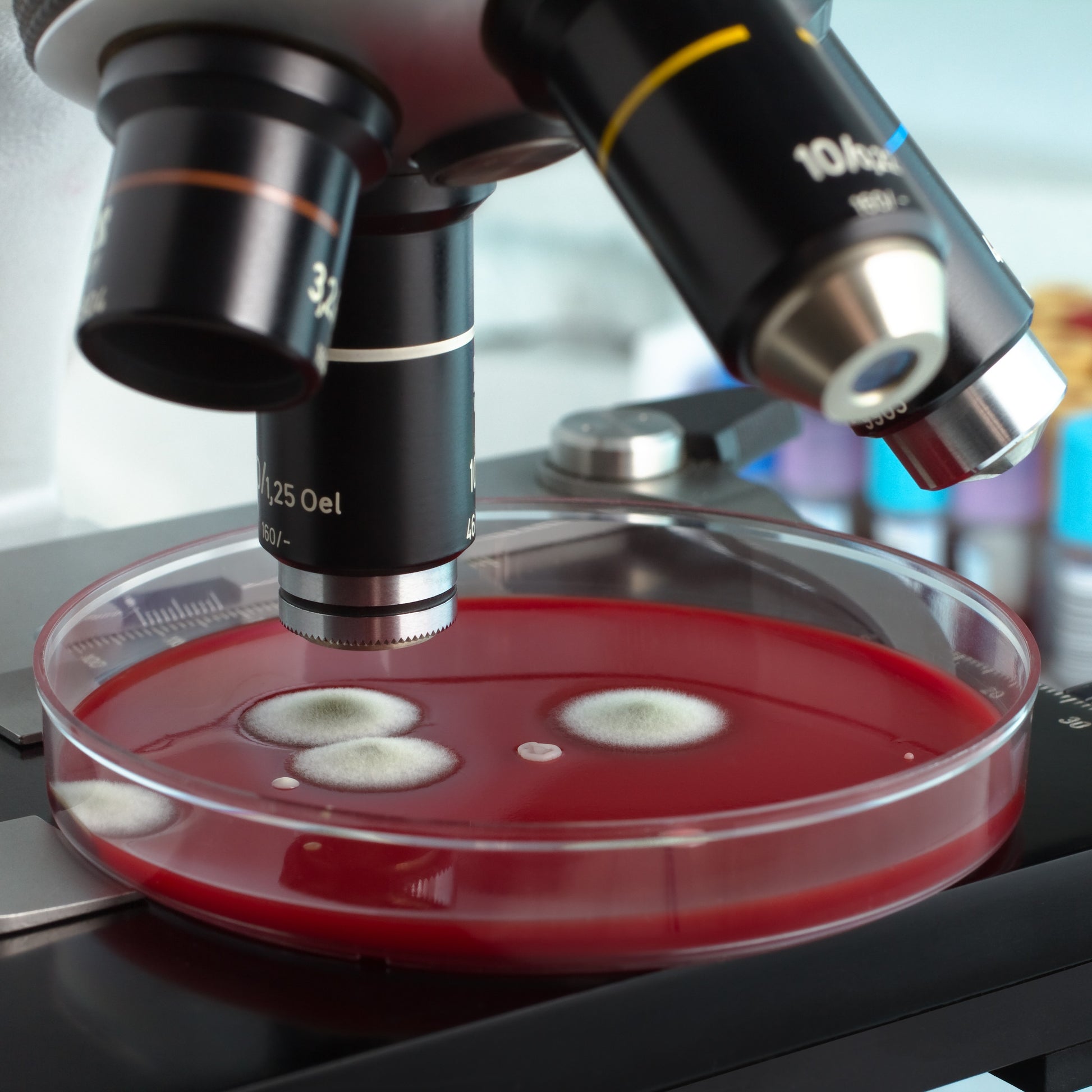 <Looking at furry mold growths on a round red blood agar plate using a microscope. Credit> AdobeStock_109808595