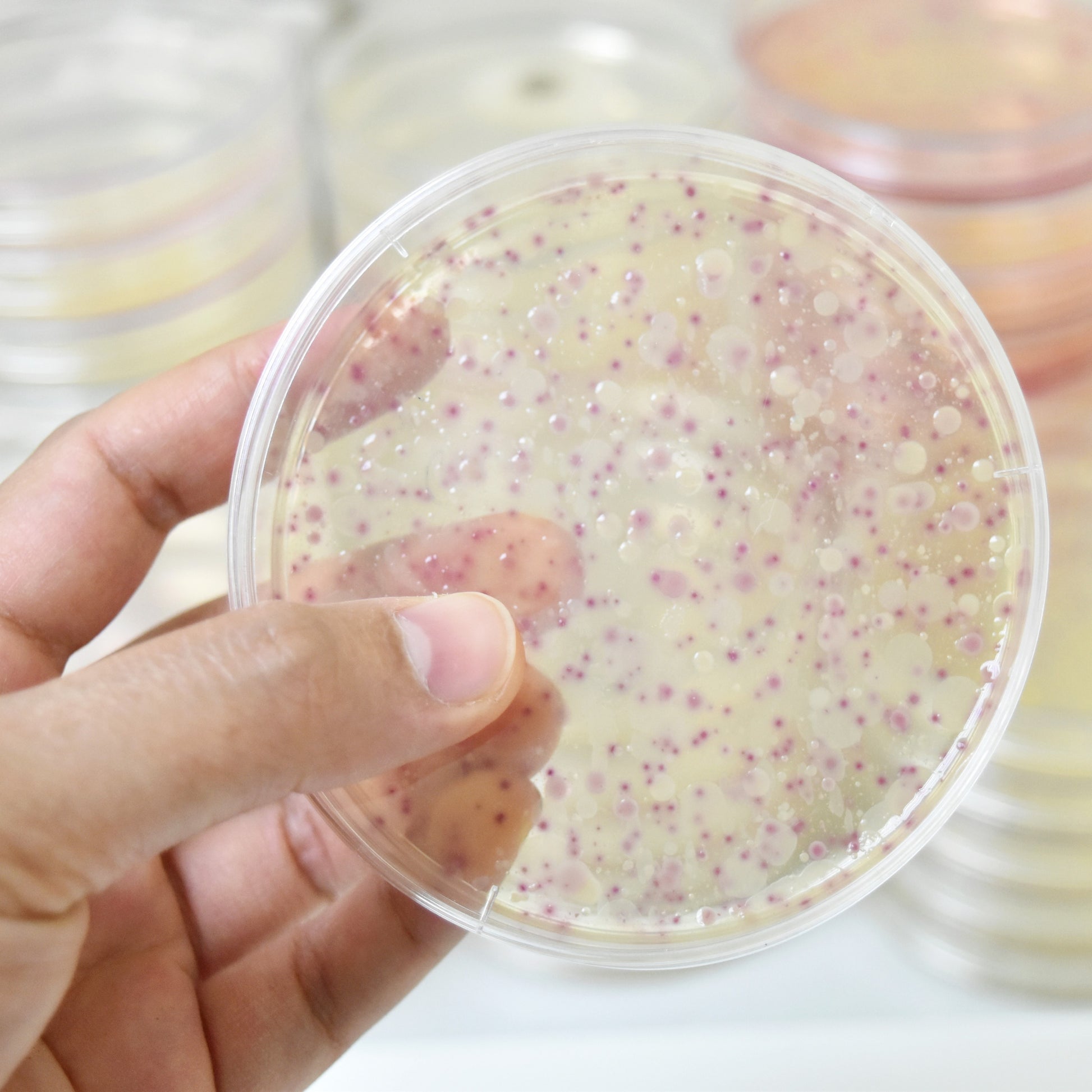 <Hand holding a round agar plate covered in small round growths that have been dyed reddish purple to help identify them. Credit> AdobeStock_297361136