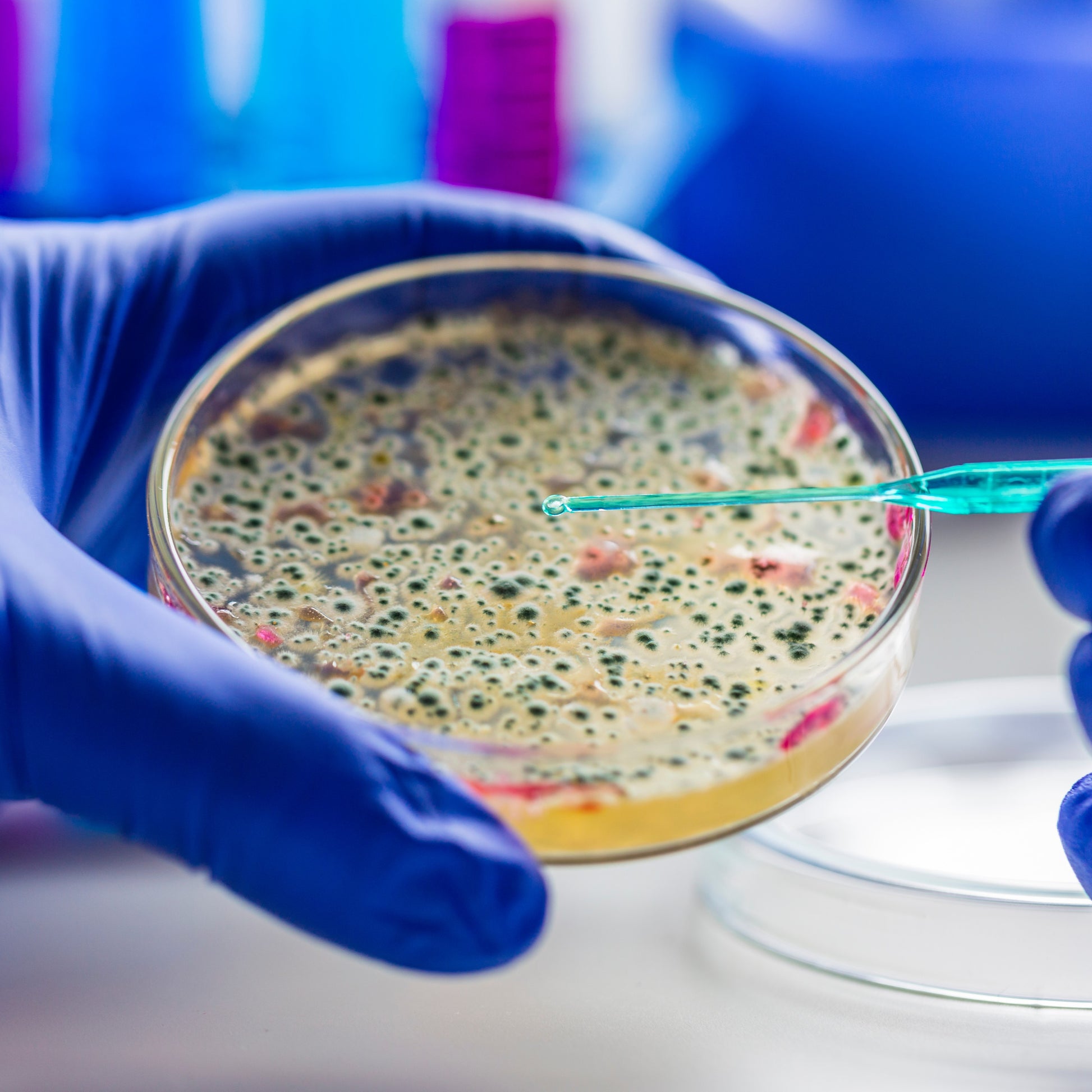 <Microbiologist hand in blue glove putting stain on bacteria colonies on a round agar plate with a pipette to differentiate them green and pink. Credit> AdobeStock_322268844