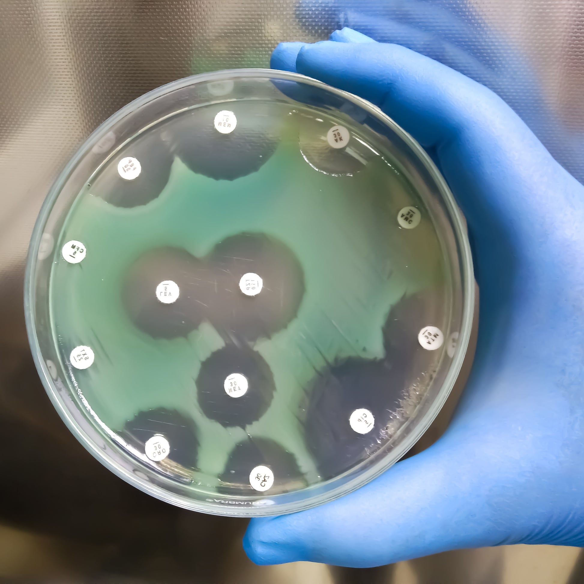 <Pseudomonas aeruginosa with a blue green colour on a nutrient agar plate, where various drugs have been applied on white dots, some successfully killing it leaving a colourless circle and other unsuccessful. Credit> AdobeStock_430064548