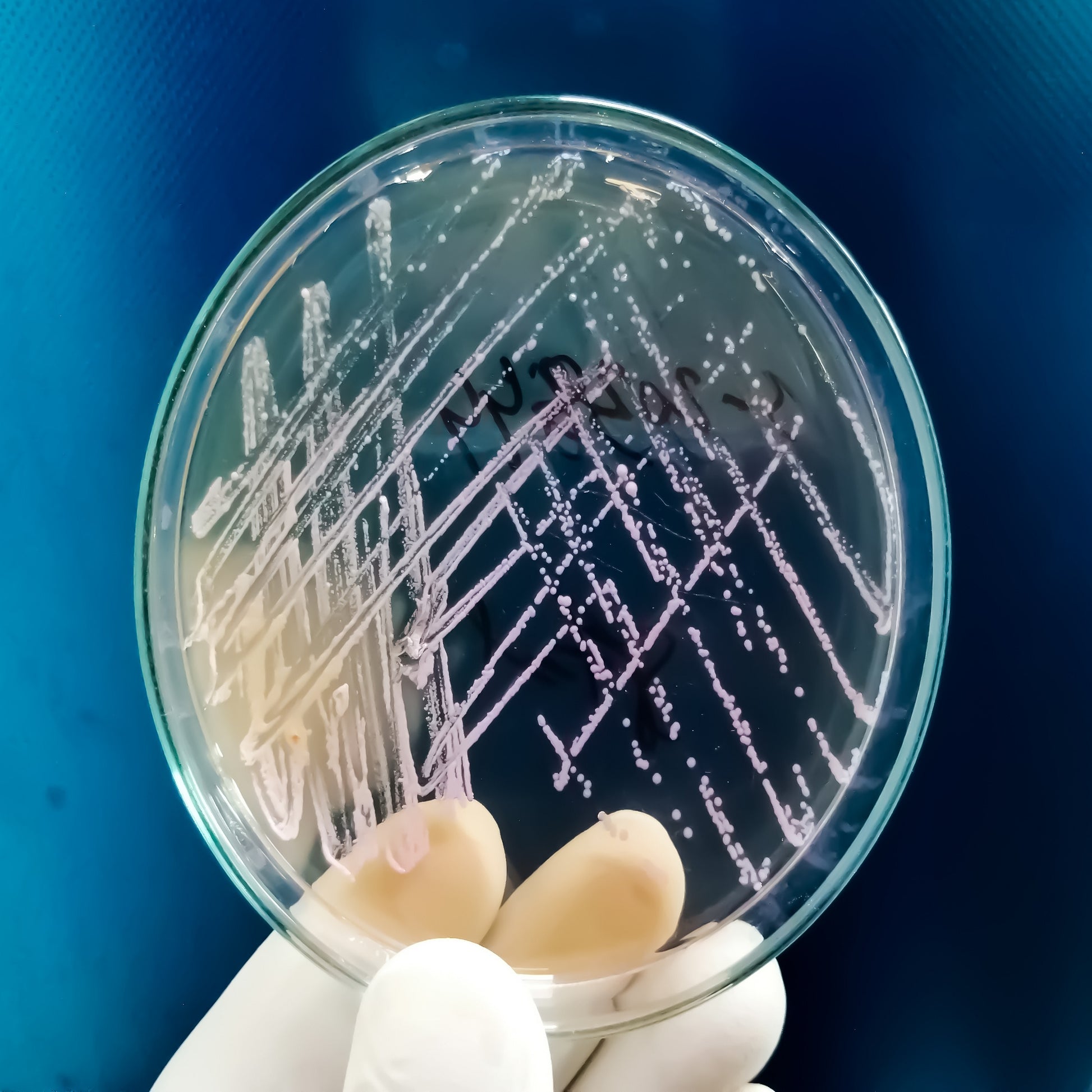 <Hand holding up a round agar plate showing growth of small white colonies everywhere it has been streaked. Credit> AdobeStock_454349873