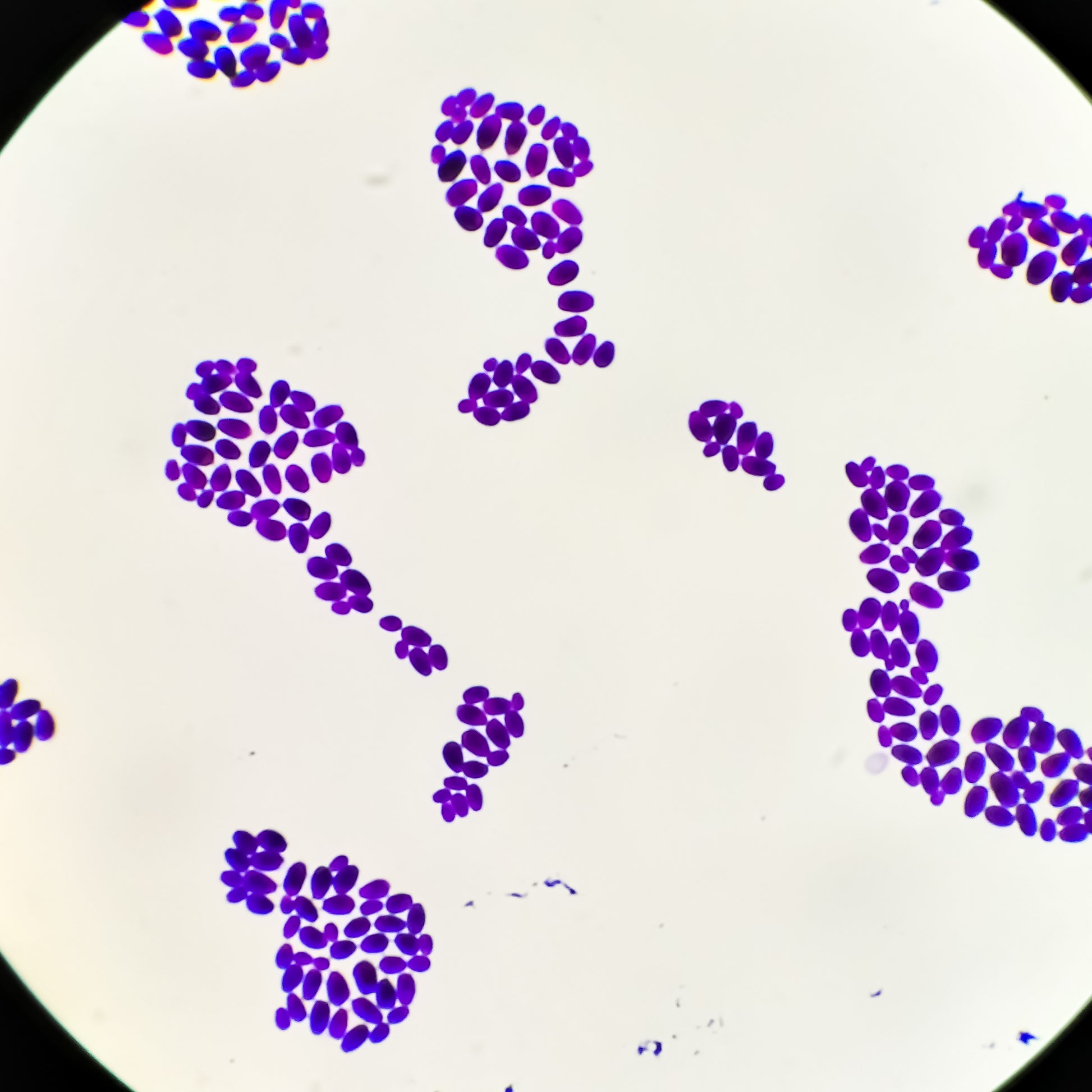 <Seen under the microscope, purple gram stained oval buds of Candida albicans colonies arranged in groups with a head and a tail. Credit> AdobeStock_472332007