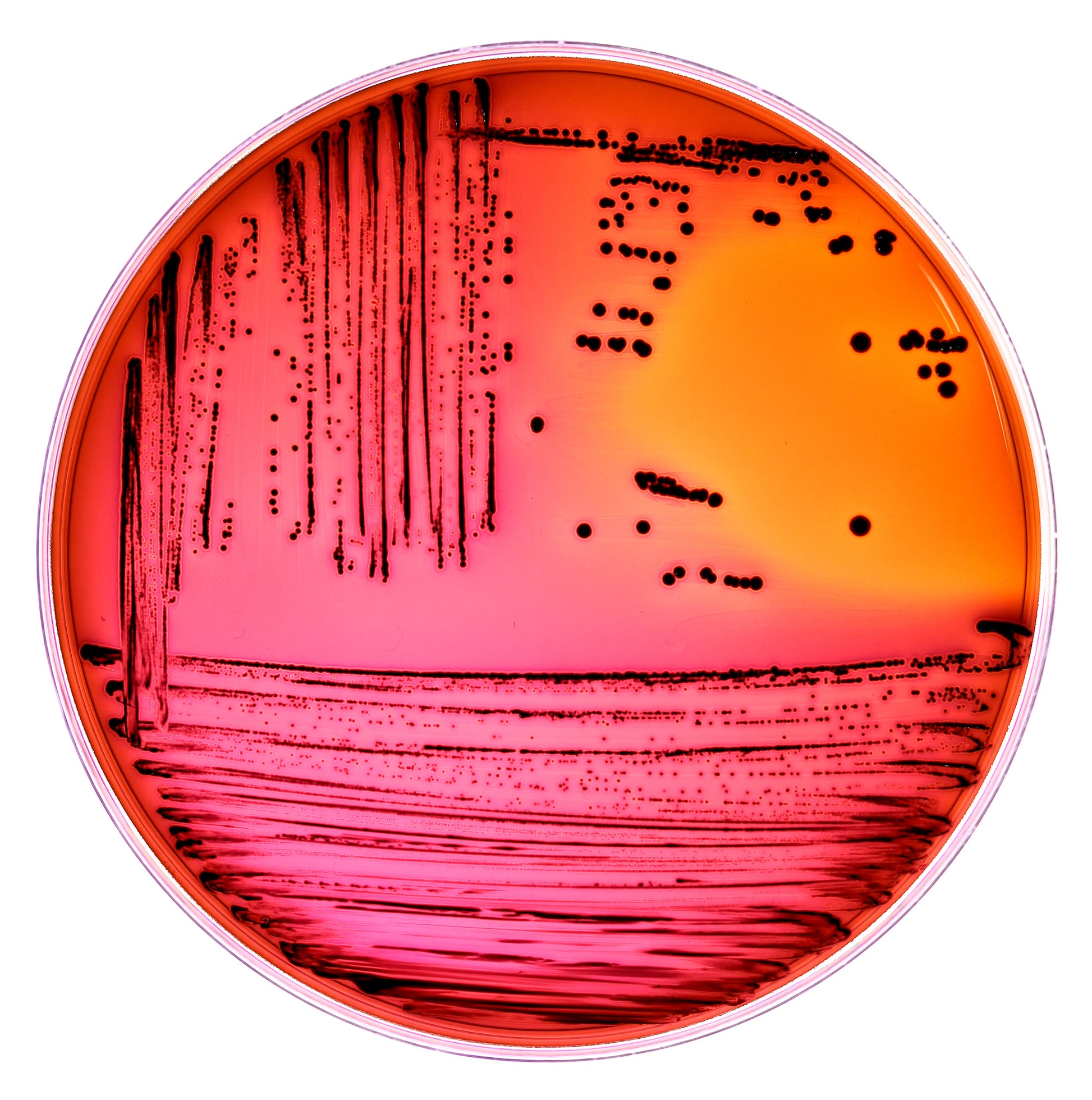 <E coli colonies showing as black dots on redMacconkey agar in a round petri dish. Credit> AdobeStock_482128211