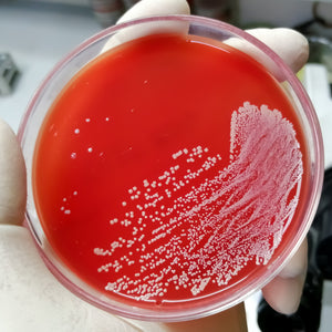 <Hand of microbiologist in white glove holding a round red blood agar plate showing a white growth of microorganisms where the plate has been streaked with product. Credit> AdobeStock_482355351