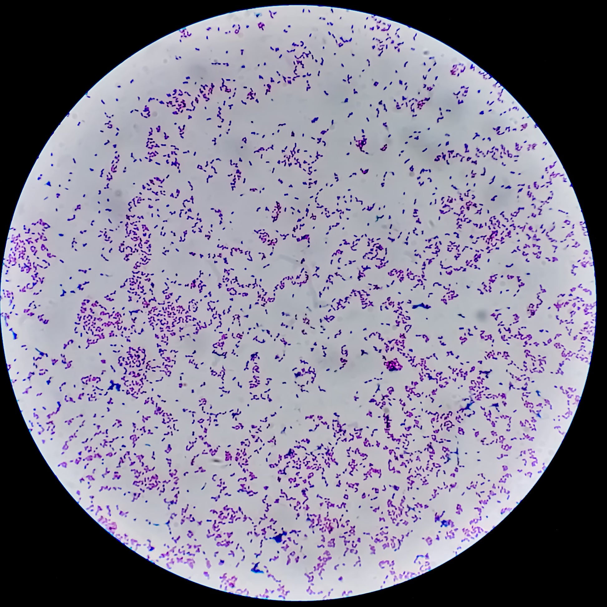 <Example of a gram stain test where crystal violet has been used to identify by pink colour gram negative bacteria in this case E coli. Credit> AdobeStock_488852896