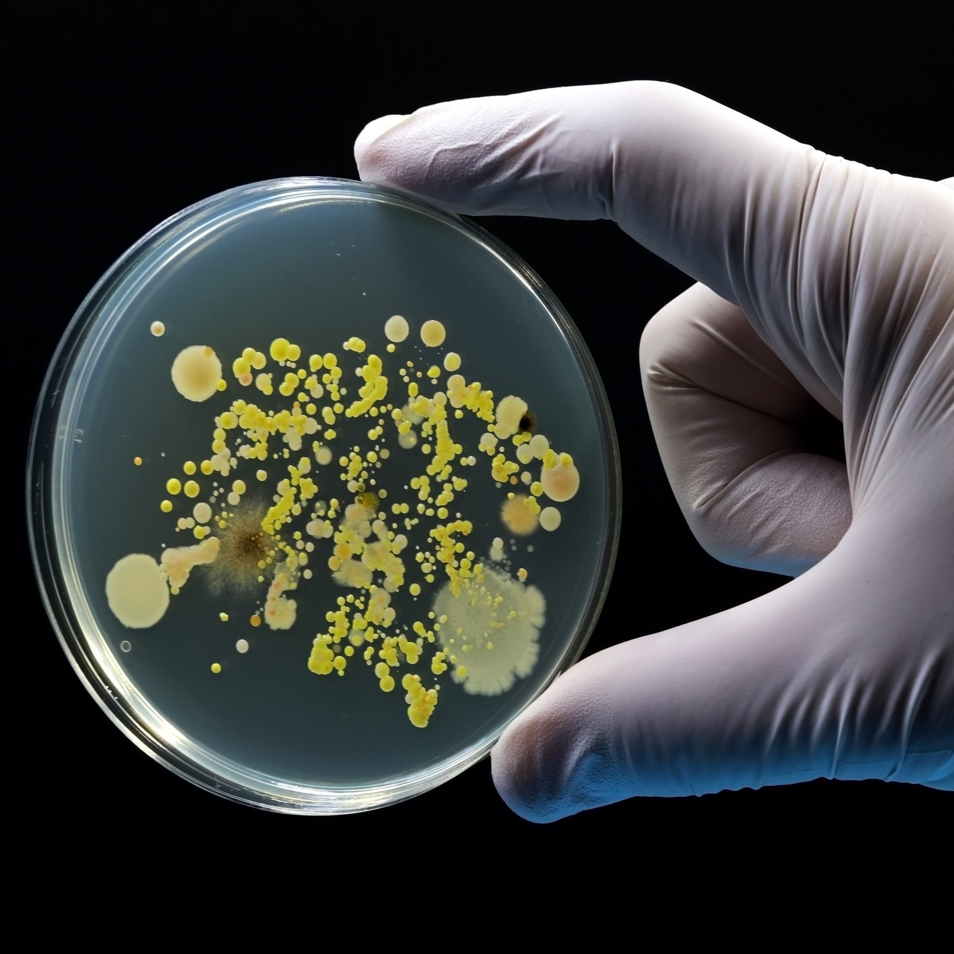 <Microbiologist holding an agar plate with several types of bacterial growth, some small round and yellow, some large and spreading, some black and wispy. Credit> AdobeStock_554420088