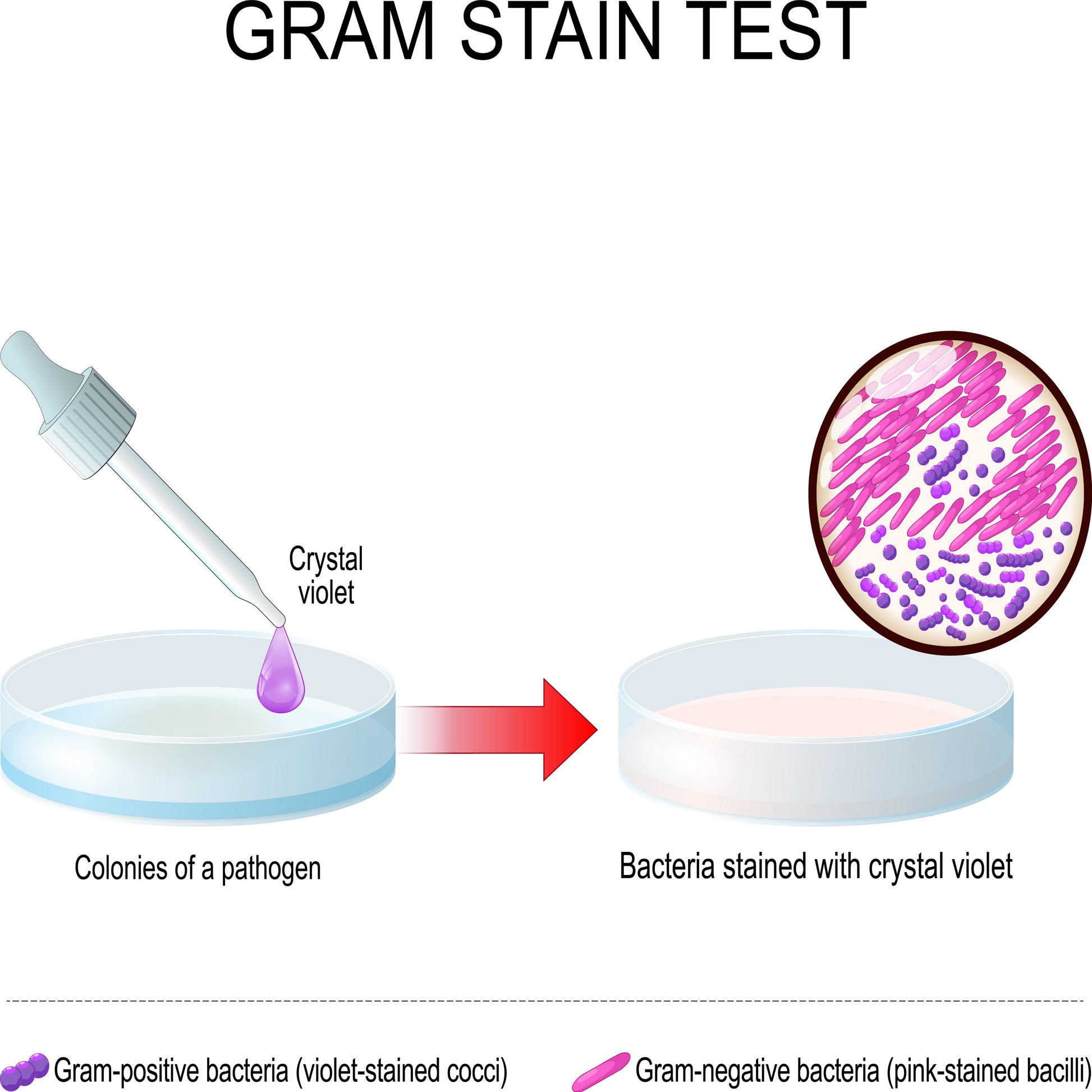 <Poster of a gram stain test where crystal violet dye is used to differentiate gram positive bacteria rods, which appear violet, from gram negative bacteria rods which appear pink. Credit> AdobeStock_645257441