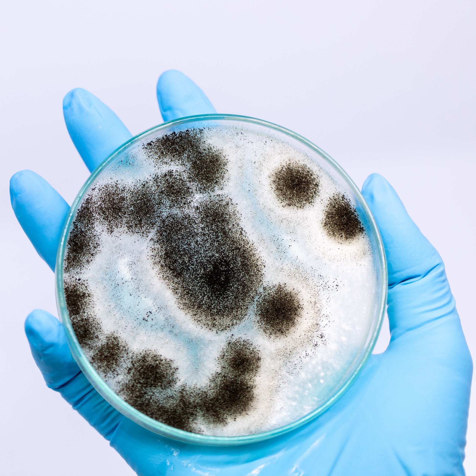 <Hand wearing blue glove holding a TYMC plate with suspected growth of pathogenic black mold Aspergillus, seen as round circles made up of little black dots. Credit> 131671003
© Piyapong Thongdumhyu
| Dreamstime.com