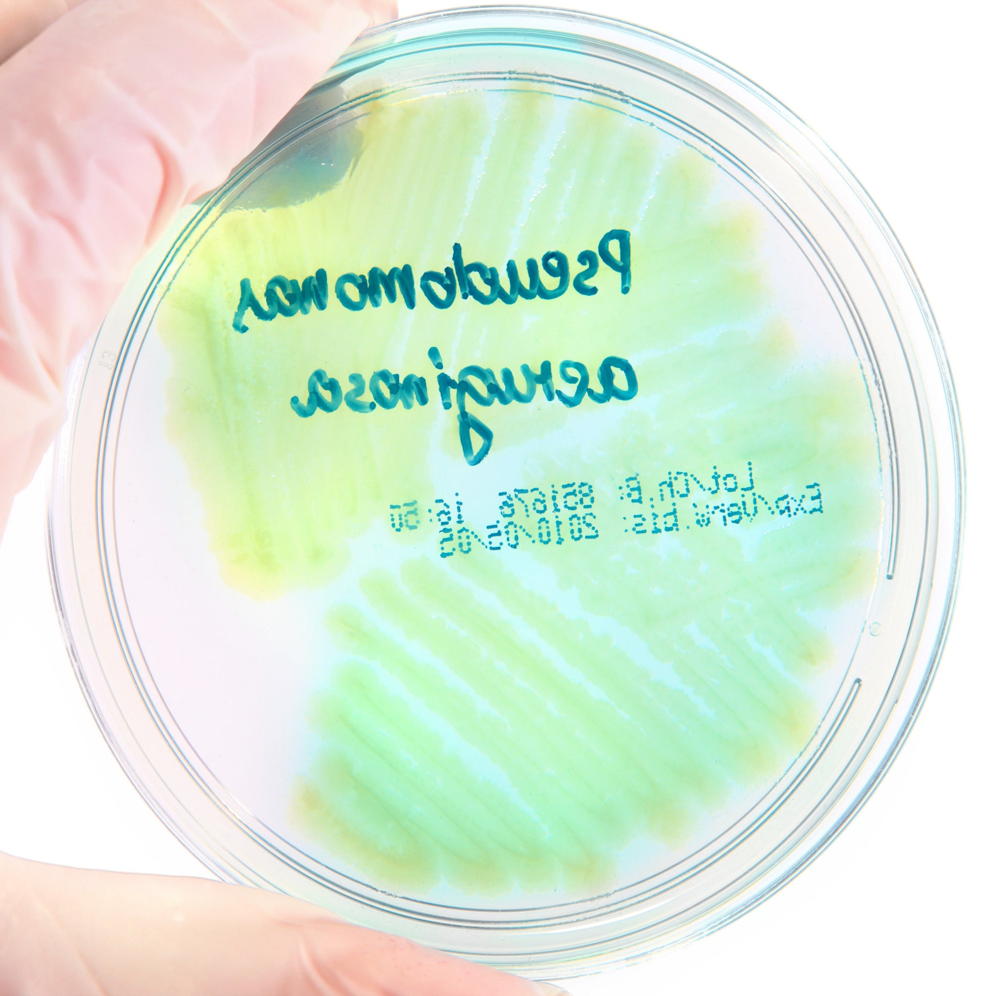 <Pseudomonas aeruginosa colonies on a round nutrient agar plate showing as spreading, opaque, translucent with a blue green hint. Credit> 13234601 © Amaviael
| Dreamstime.com