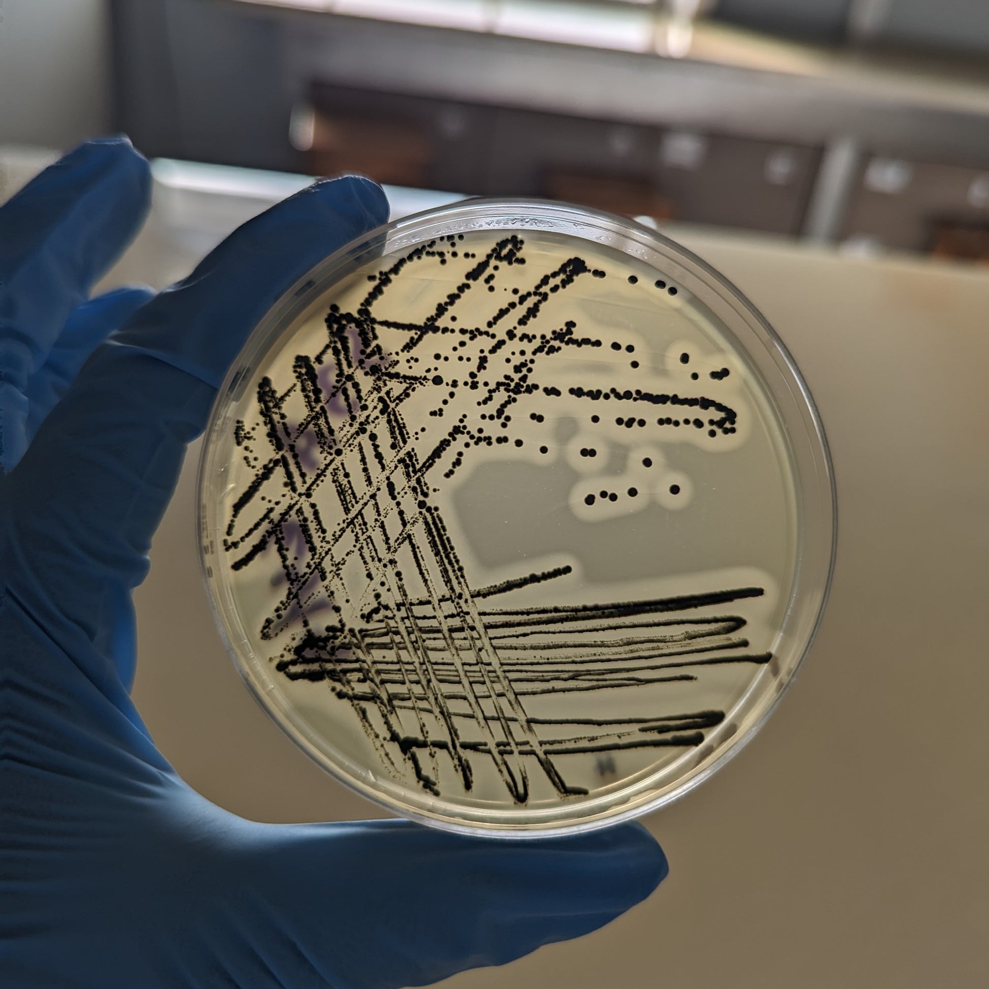 <Staphylococcus aureus growth of round, black spots, as it appears on Baird Parker agar plates surrounded by a paler area. Credit> 319984179
© Nandani Bridglal | Dreamstime.com