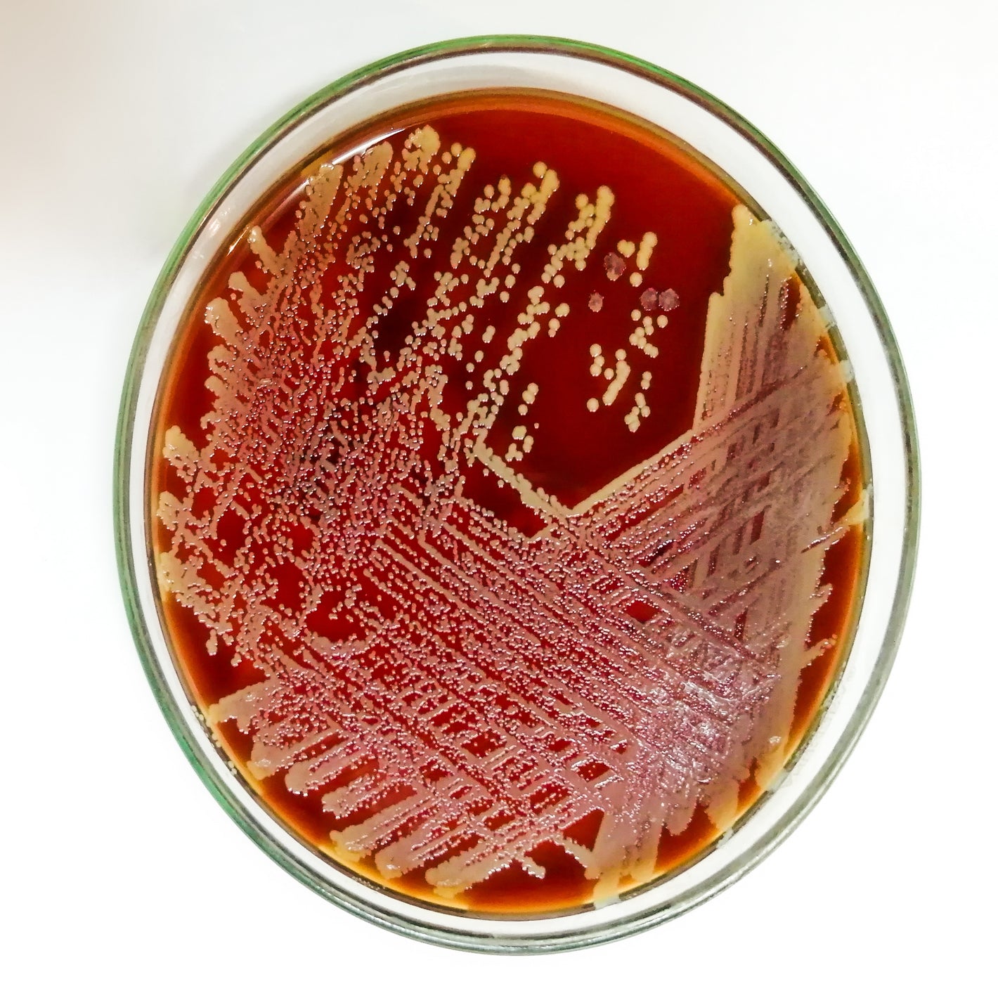 <Opaque, white, round colonies of staphylococcus aureus on a round red blood agar petri dish. Credit> 2137189439 by Saiful52 @ Shutterstock