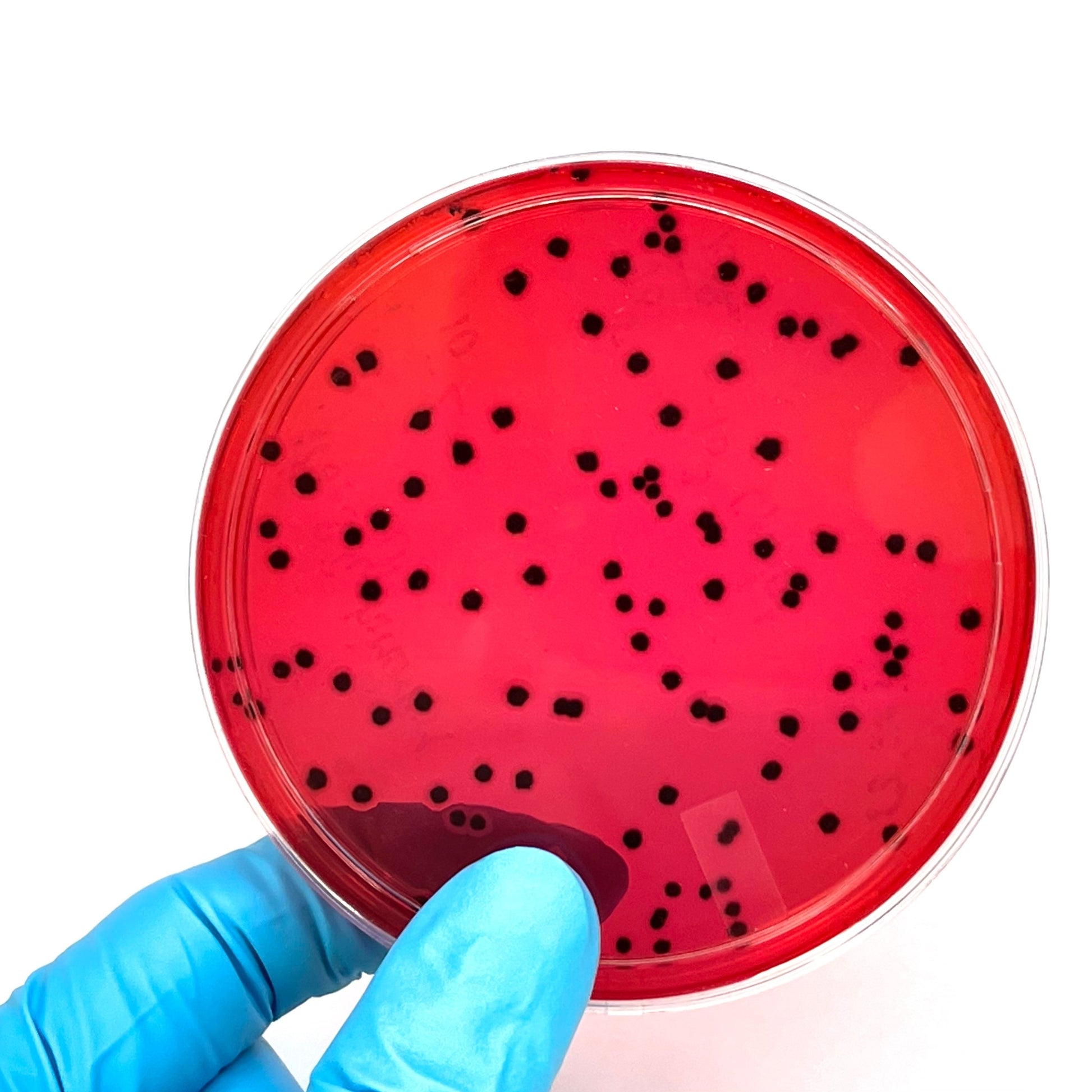 <Hand in blue glove holding a round XLD agar plate showing Salmonella colonies as small, irregular spaced black spots on red media. Credit> 2269181847 by Pattar.w092 @ Shutterstock